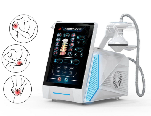 Immagine di Focus Shockwave – Terapia a onde d'urto